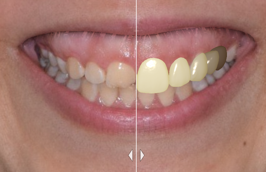 DSD Patient Photo